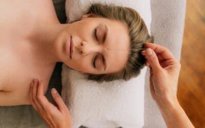 How Acupuncture Can Improve Digestion