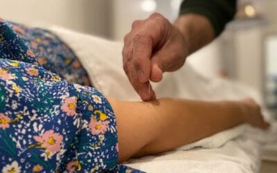 How Acupuncture Facilitates Effective Weight Loss