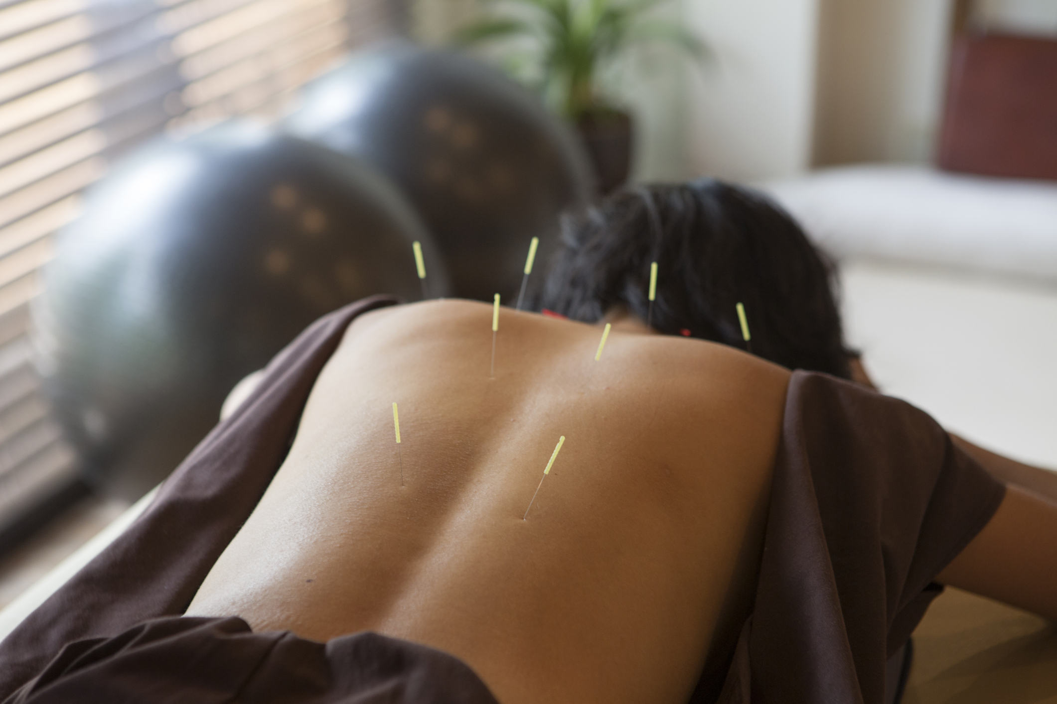 Acupuncture Appointment