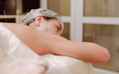 How an Acupuncture and Wellness Clinic Can Transform Your Health Naturally