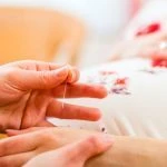 Acupuncture