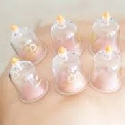 best cupping Albuquerque